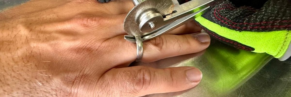 FW Weinheim: Feuerwehr entfernt Ring von Finger