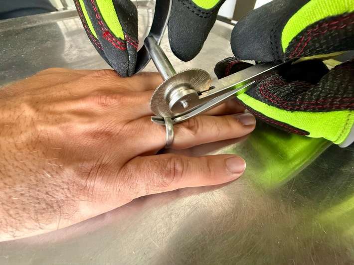 FW Weinheim: Feuerwehr entfernt Ring von Finger